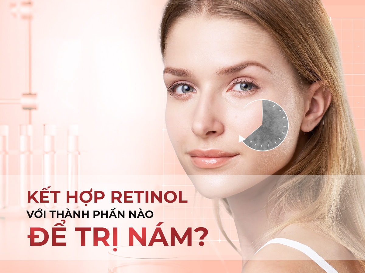 Kết hợp retinol với gì để trị nám? Bật mí cách sử dụng retinol trị nám hiệu quả