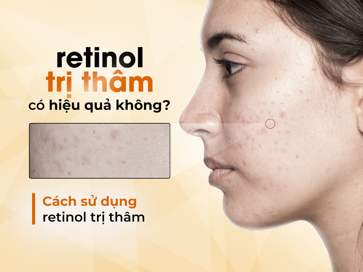 Retinol trị thâm có hiệu quả không? Cách sử dụng retinol trị thâm