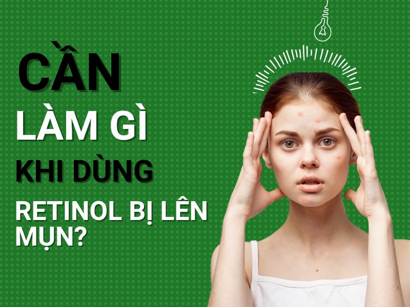 Cần làm gì khi dùng retinol bị lên mụn?