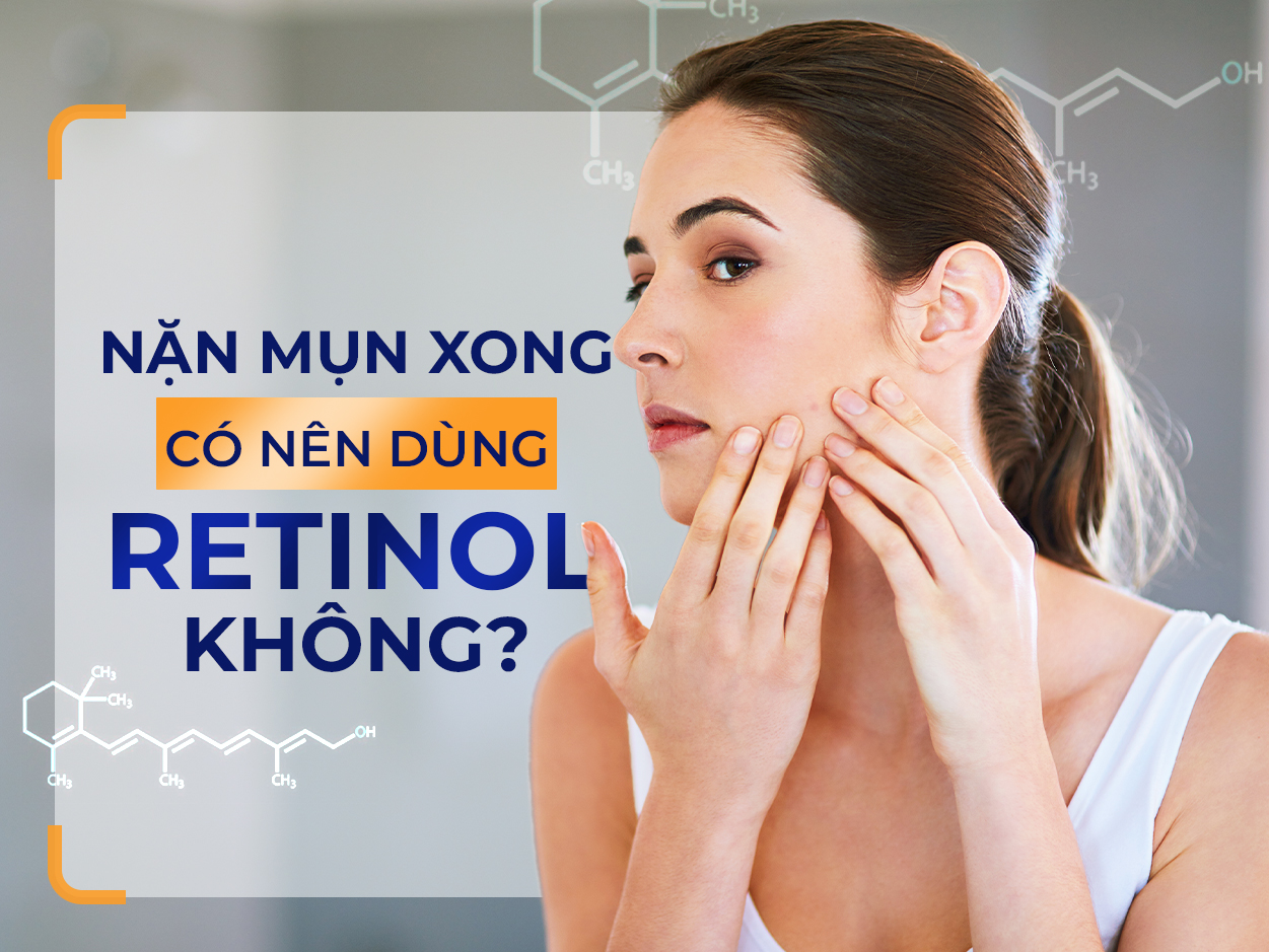 Sau khi nặn mụn xong có nên dùng retinol không? - Những lưu ý cần phải biết