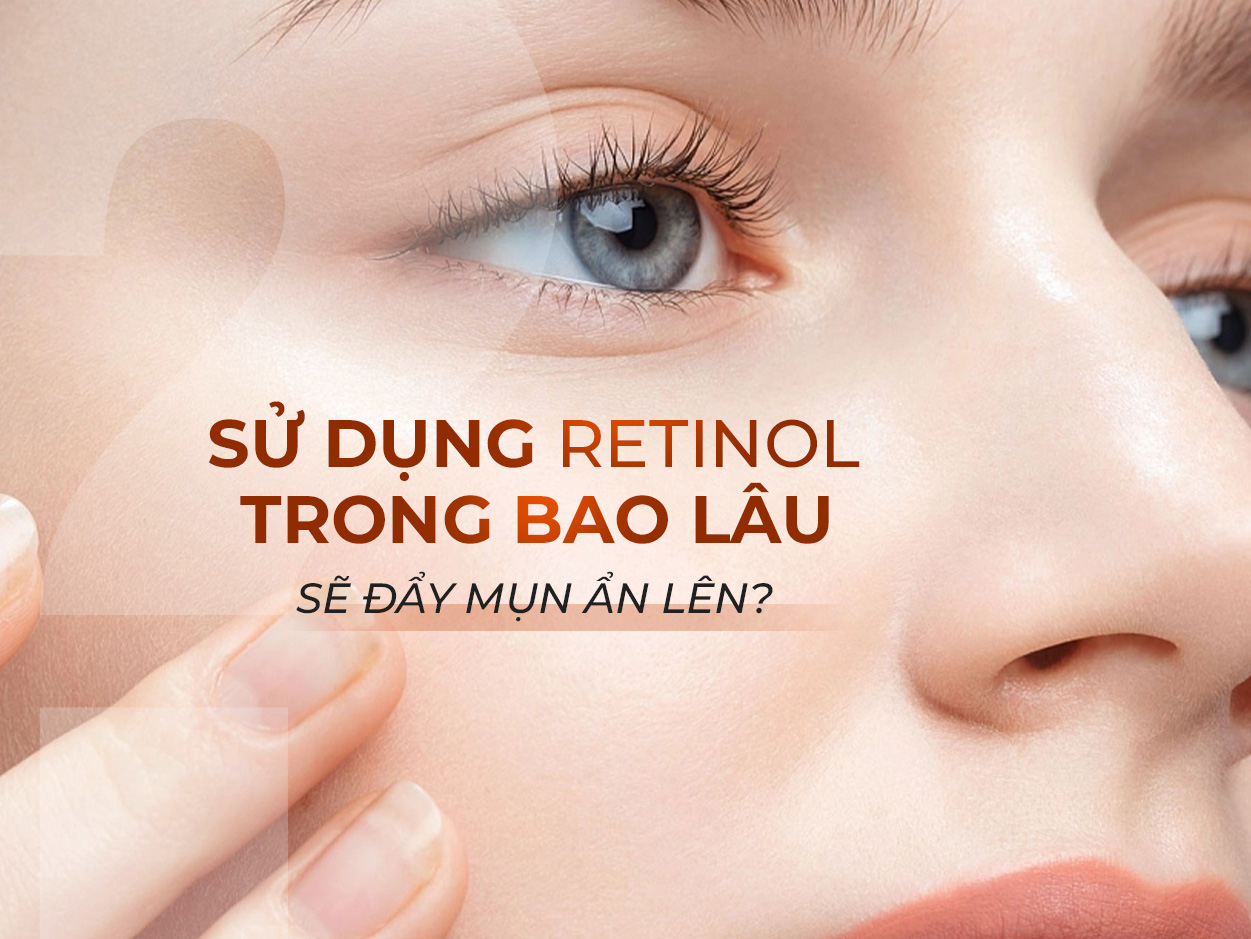 Retinol trị mụn ẩn