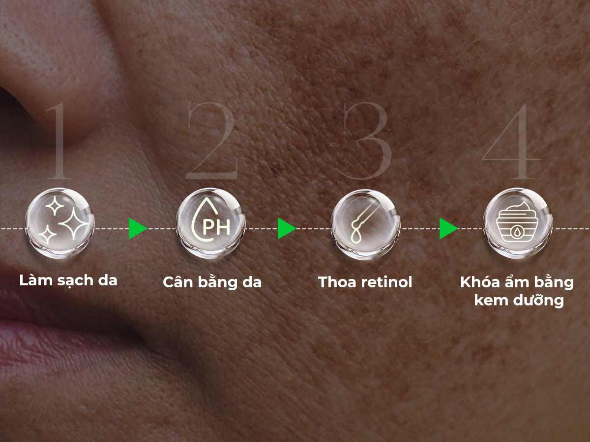 Các bước thoa retinol trị nám 