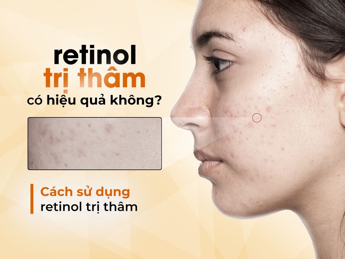 Retinol trị thâm có hiệu quả không? Cách sử dụng retinol trị thâm  